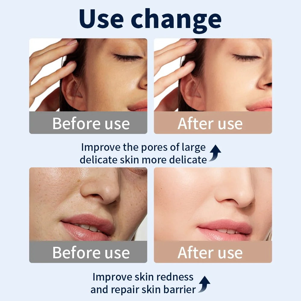 Advanced Led Therapy Mask